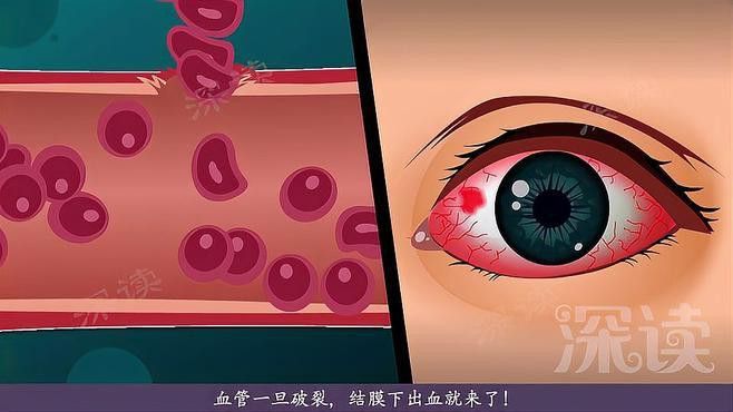 紅龍蒙眼病的癥狀有哪些？ 紅龍蒙眼病的癥狀有哪些？ 龍魚百科 第1張