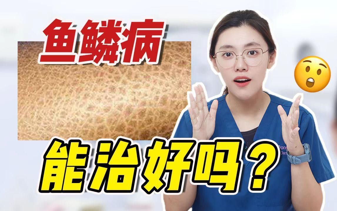 病態(tài)脫皮的癥狀有哪些？