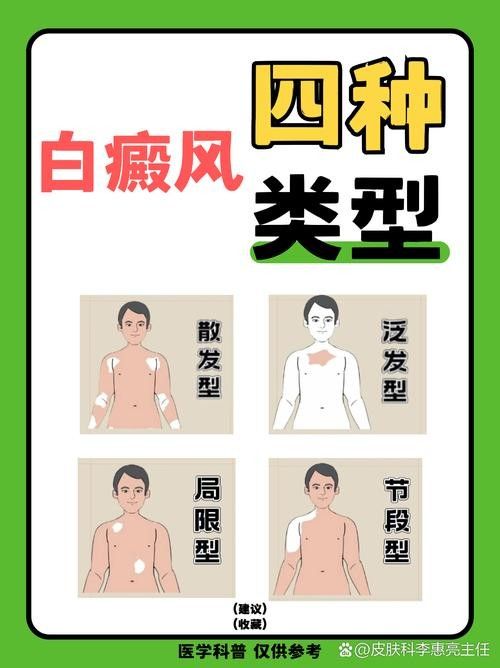 銀龍魚全身發(fā)白是什么原因造成的圖片