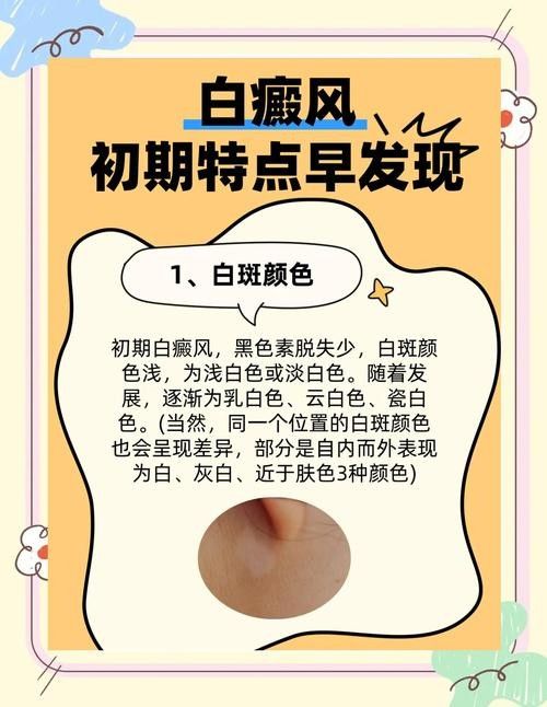 銀龍魚全身發(fā)白是什么原因造成的圖片