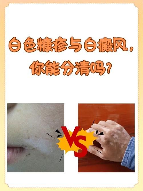 銀龍魚全身發(fā)白是什么原因造成的圖片