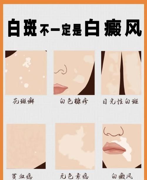 銀龍魚全身發(fā)白是什么原因造成的圖片
