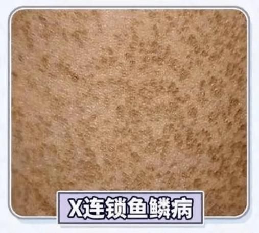 龍魚鱗病圖片對照 龍魚鱗病圖片對照 龍魚百科 第3張