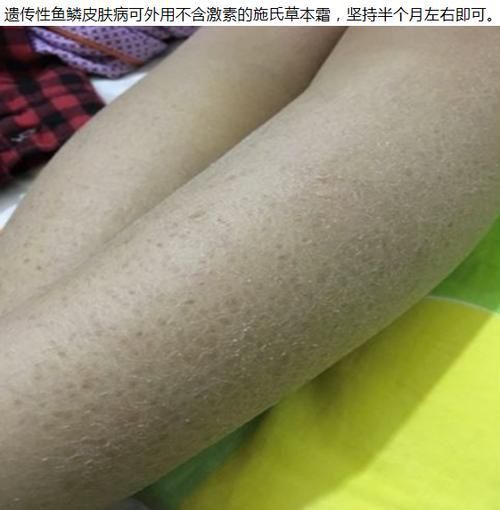 龍魚鱗病圖片對照 龍魚鱗病圖片對照 龍魚百科 第6張