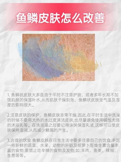 龍魚鱗病圖片對照 龍魚鱗病圖片對照 龍魚百科 第9張
