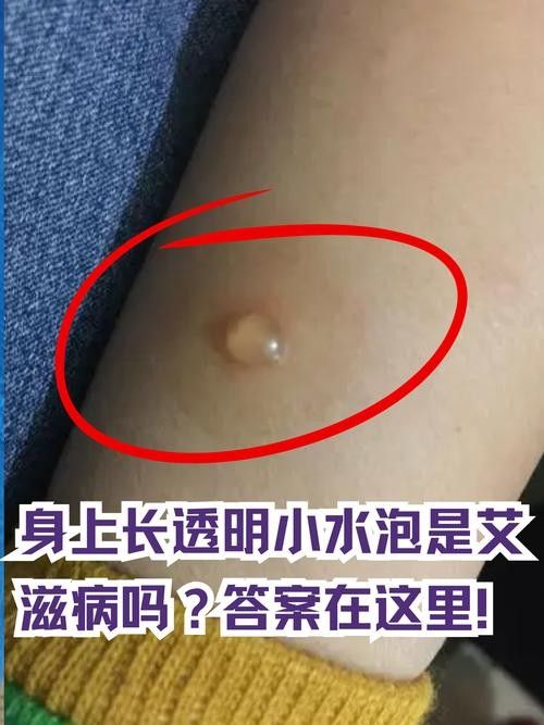 銀龍魚身上起白泡怎么辦圖片