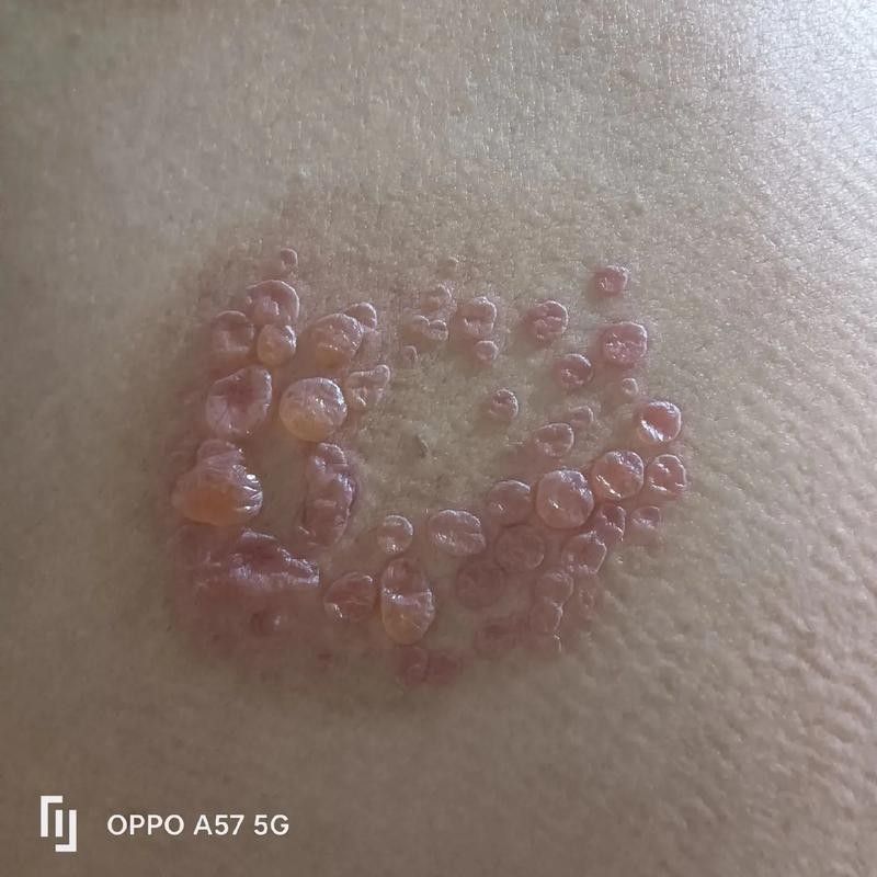 銀龍魚身上起白泡怎么辦圖片