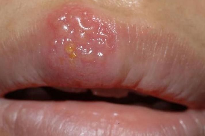 銀龍魚身上起白泡怎么辦圖片