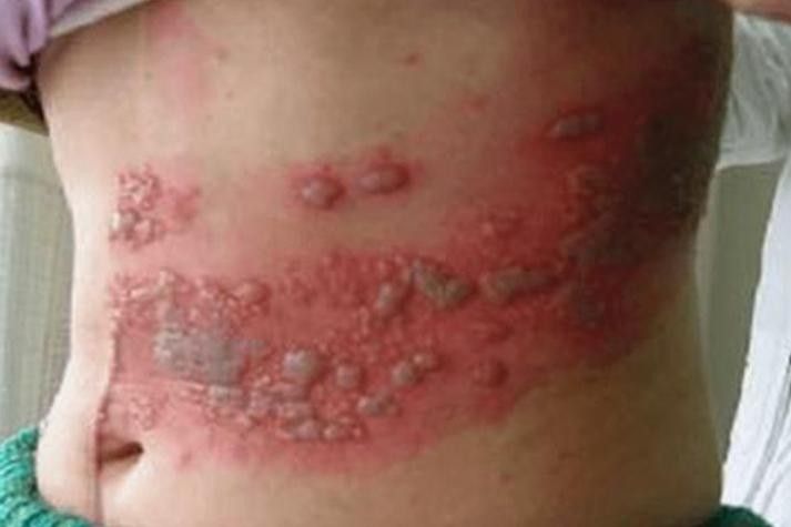 銀龍魚身上起白泡怎么辦圖片