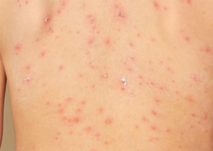 銀龍魚身上起白泡怎么辦圖片