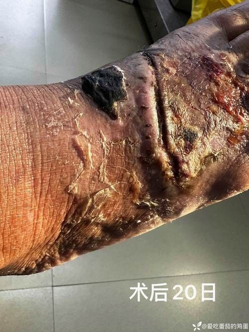 銀龍魚身上起白泡怎么辦圖片