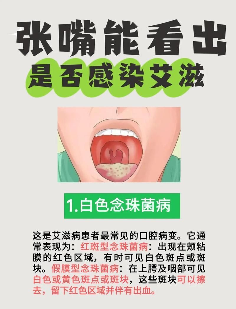 龍魚(yú)細(xì)菌是艾滋病的早期癥狀嗎 龍魚(yú)細(xì)菌是艾滋病的早期癥狀嗎 龍魚(yú)百科 第6張