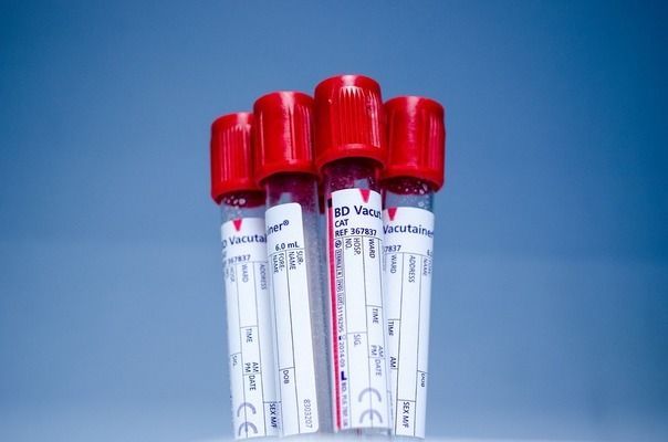 紅龍魚過濾系統(tǒng)推薦：紅龍魚專用過濾器品牌排行