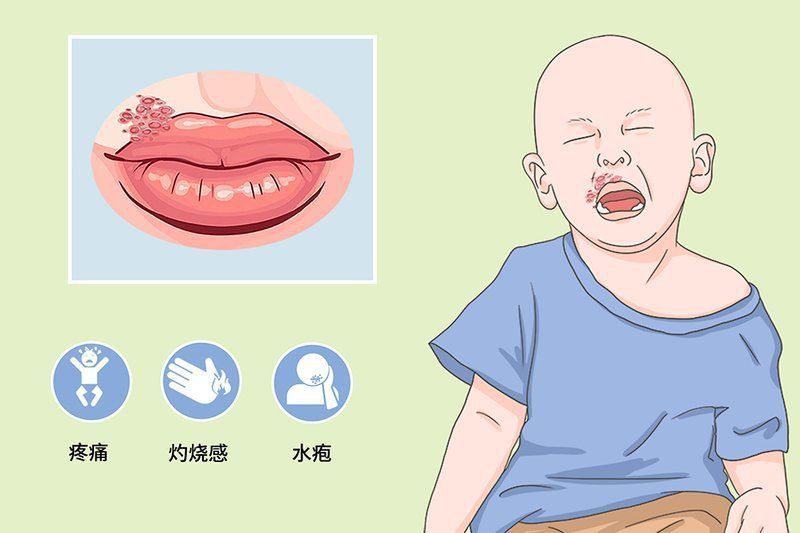 哪種類型的炸鱗病傳染性最強？ 哪種類型的炸鱗病傳染性最強？ 龍魚百科 第2張