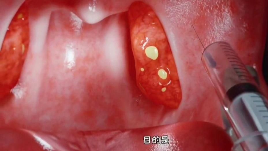 能提供更詳細的手術步驟嗎? 龍魚百科 第3張 能提供更詳細的手術步驟嗎? 能提供更詳細的手術步驟嗎? 龍魚百科 第3張