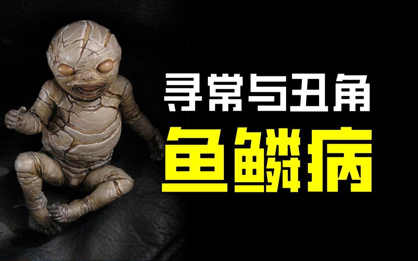 如何判斷魚鱗病的嚴重程度？