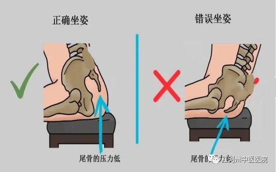 有哪些運動適合病理性沉尾患者？：病理性沉尾患者運動鍛煉有哪些