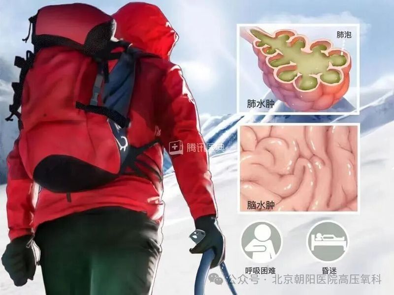 交叉感染期間如何加強溶氧？：“人在高原”該不該吸氧 交叉感染期間如何加強溶氧？：“人在高原”該不該吸氧 龍魚百科 第3張
