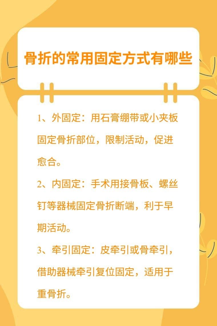 哪種固定方式最牢固？：哪種固定方式最牢固