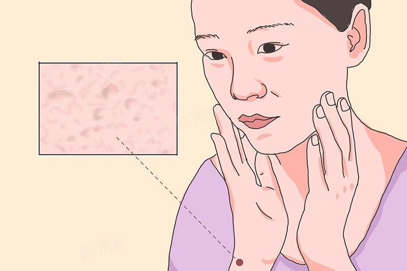 松鱗病能自然緩解嗎？：【健康科普】魚鱗病怎么治療護(hù)理