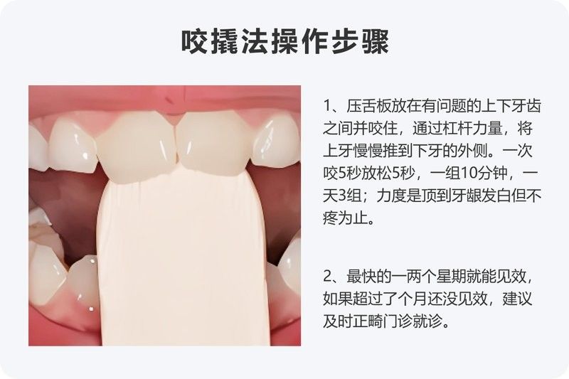 如何用壓舌板觀察咽喉部？：使用壓舌板觀察咽喉部是一種常見的口腔護(hù)理工具