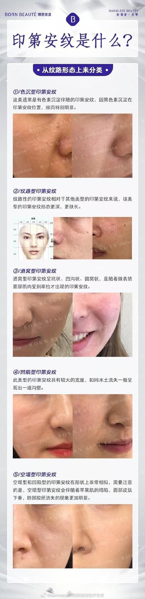 吉印和馬印哪個更好？：“吉印”和“馬印”哪個更好？