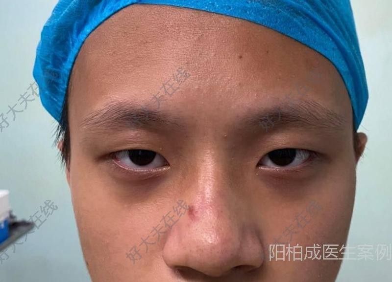 廈門哪家醫(yī)院有龍魚手術案例？：廈門大學附屬第二醫(yī)院、廈門大學附屬第二醫(yī)院龍魚手術