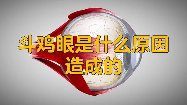 后天形成的鉆石眼如何治療：后天性白內(nèi)障的治療方法