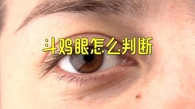 后天形成的鉆石眼如何治療：后天性白內(nèi)障的治療方法