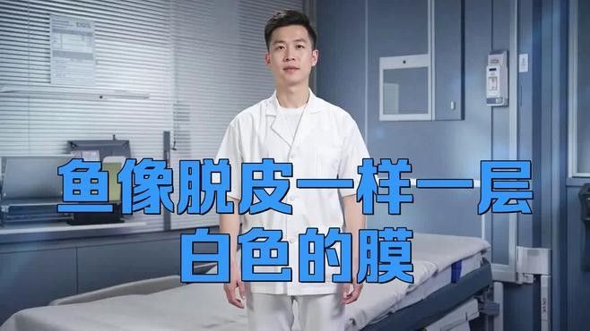 龍魚鰭上的白色絮狀物會傳染嗎？：龍魚身上有白色絮狀物怎么治 龍魚鰭上的白色絮狀物會傳染嗎？：龍魚身上有白色絮狀物怎么治 龍魚百科 第2張