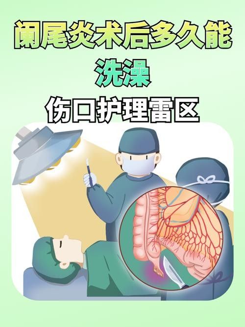 爛尾手術后如何預防感染？（南陽醫專一附院闌尾炎手術后的護理）