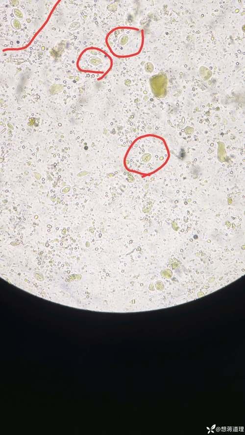 如何預防龍貓感染賈第鞭毛蟲？（如何預防龍貓感染賈第鞭毛蟲）