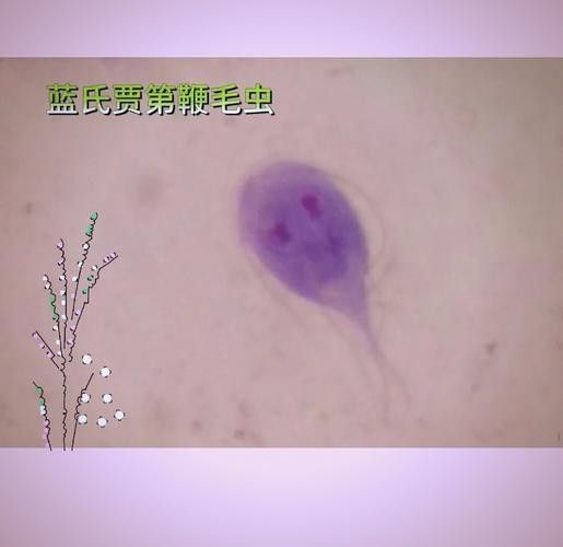 如何預防龍貓感染賈第鞭毛蟲？（如何預防龍貓感染賈第鞭毛蟲）