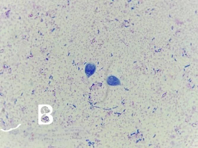 如何預防龍貓感染賈第鞭毛蟲？（如何預防龍貓感染賈第鞭毛蟲）