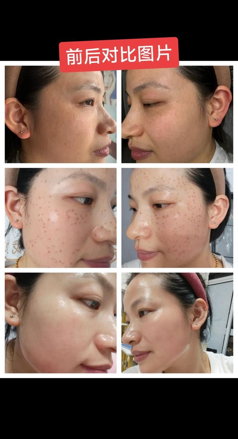 如何修復(fù)模糊的壁紙？（壁紙模糊怎么修復(fù)）