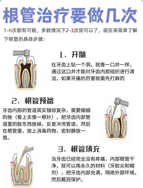 根管治療期間如何保持口腔衛(wèi)生（李祥副主任醫(yī)師三甲根管治療期間飲食注意事項有哪些） 根管治療期間如何保持口腔衛(wèi)生（李祥副主任醫(yī)師三甲根管治療期間飲食注意事項有哪些） 龍魚百科 第2張