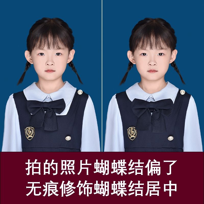 我的虎魚真菌感染了要怎么處理 蝴蝶結(jié)修正(蝴蝶結(jié)修正可以拯救一下嗎?) 龍魚論壇 蝴蝶結(jié)修正(蝴蝶結(jié)修正可以拯救一下嗎?) 蝴蝶結(jié)修正(蝴蝶結(jié)修正可以拯救一下嗎?) 龍魚論壇
