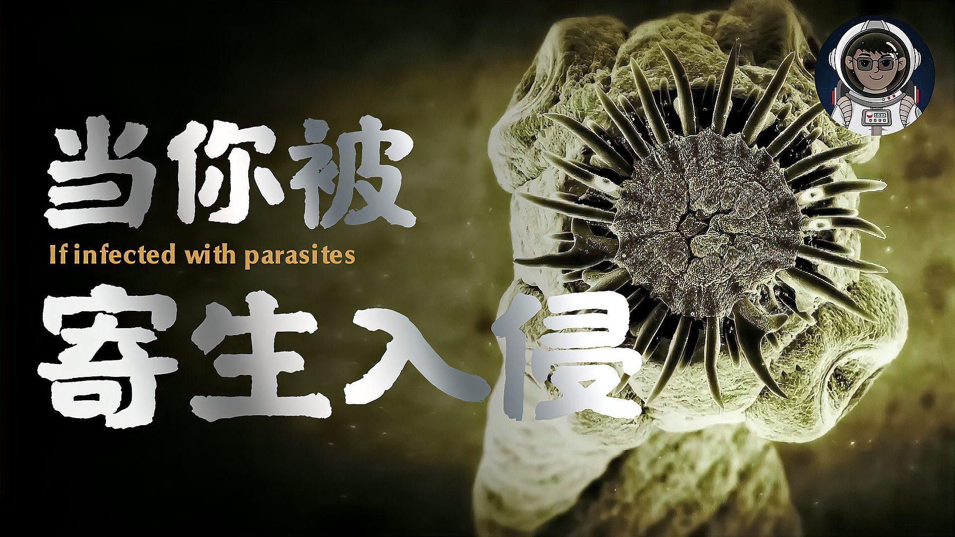 寄生蟲感染如何預防和治療 寄生蟲感染如何預防和治療 龍魚百科 第1張