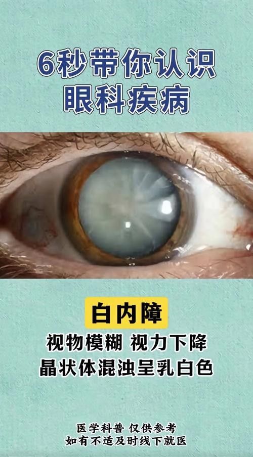 如何判斷鉆石眼是否嚴(yán)重？（判斷鉆石眼是否嚴(yán)重需要綜合考慮多個因素，眼科醫(yī)生綜合評估） 如何判斷鉆石眼是否嚴(yán)重？（判斷鉆石眼是否嚴(yán)重需要綜合考慮多個因素，眼科醫(yī)生綜合評估） 龍魚百科 第4張