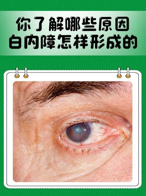 如何判斷鉆石眼是否嚴(yán)重？（判斷鉆石眼是否嚴(yán)重需要綜合考慮多個因素，眼科醫(yī)生綜合評估） 如何判斷鉆石眼是否嚴(yán)重？（判斷鉆石眼是否嚴(yán)重需要綜合考慮多個因素，眼科醫(yī)生綜合評估） 龍魚百科 第3張