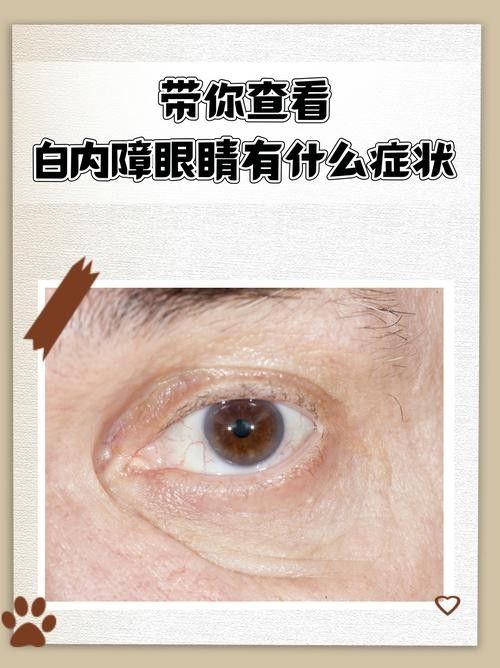 如何判斷鉆石眼是否嚴(yán)重？（判斷鉆石眼是否嚴(yán)重需要綜合考慮多個因素，眼科醫(yī)生綜合評估） 如何判斷鉆石眼是否嚴(yán)重？（判斷鉆石眼是否嚴(yán)重需要綜合考慮多個因素，眼科醫(yī)生綜合評估） 龍魚百科 第2張