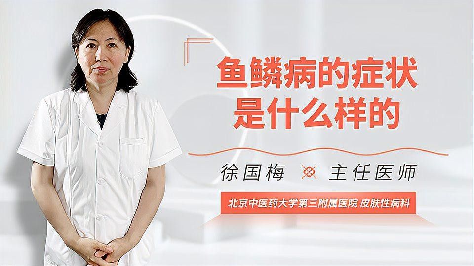 魚鱗病有哪些類型