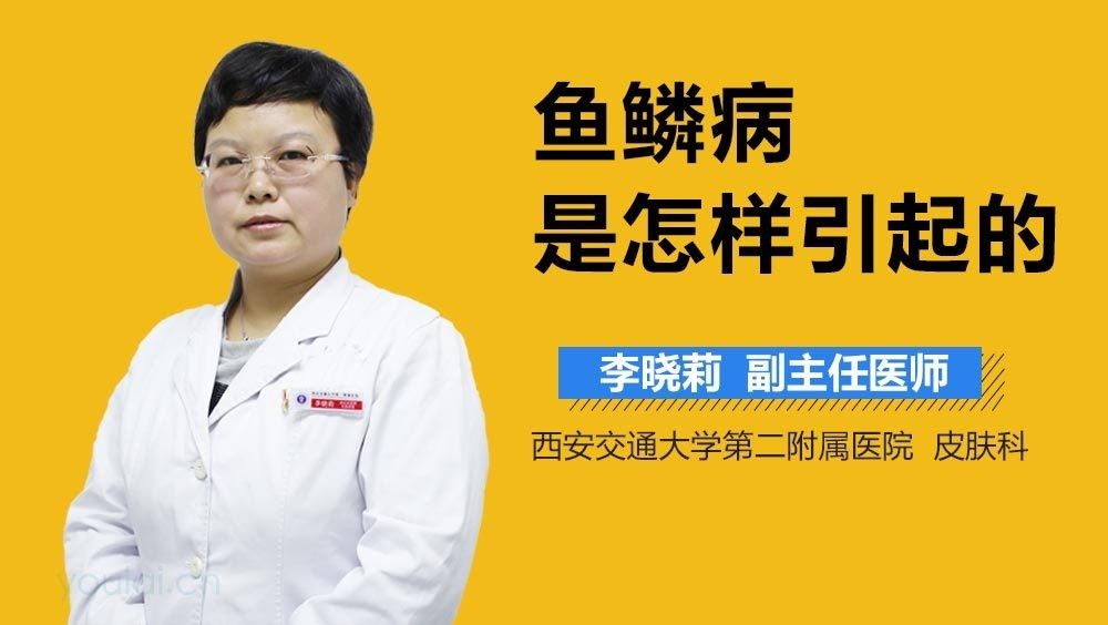 魚鱗病有哪些類型