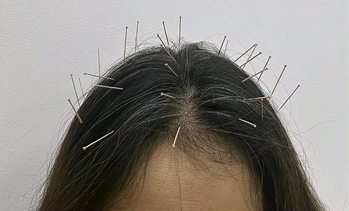 金龍魚芯片注射有風(fēng)險(xiǎn)嗎