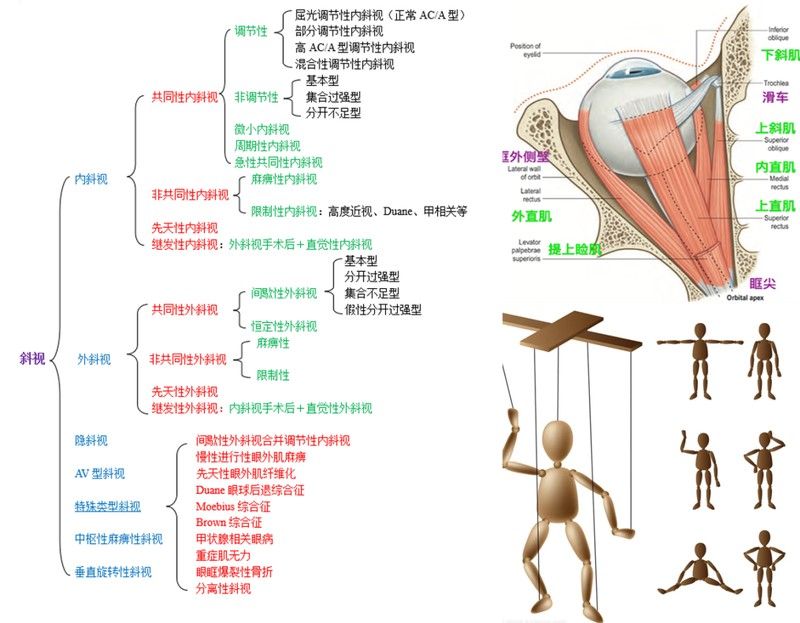 如何區(qū)分外蒙眼和內(nèi)蒙眼（內(nèi)蒙眼和外蒙眼的區(qū)別）