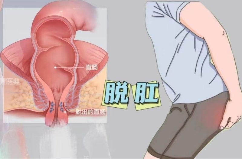 病理性拖便會自愈嗎？（張家口市第五醫院中西醫結合醫院中西醫結合醫院展開）