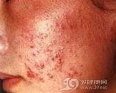 土龍魚(yú)去粘液的最佳方法（土龍魚(yú)粘液有營(yíng)養(yǎng)嗎，）