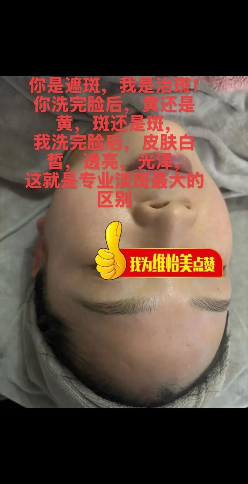 如何去除遮光板上的黃斑？（如何去除遮光板上的黃斑）