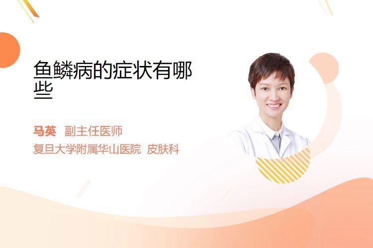 松鱗病有哪些類型（張嵐副主任醫師三甲魚鱗病的類型及癥狀有哪些）