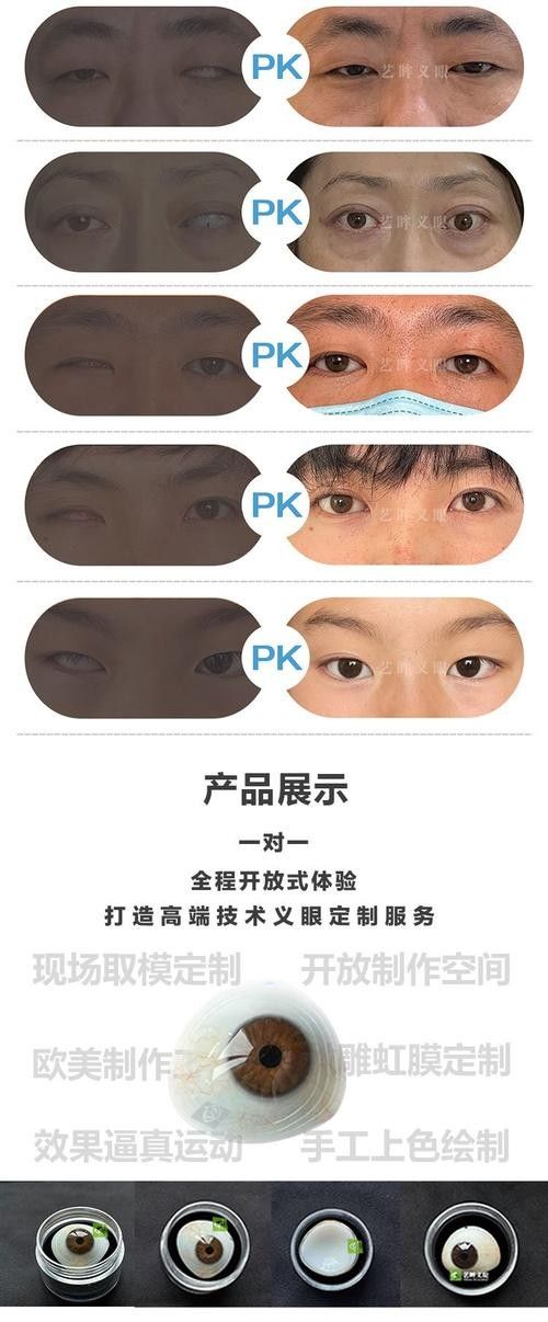 哪種材質的義眼最好？